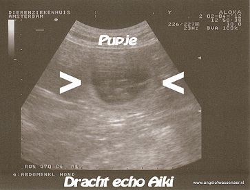 Foetus op de echo te zien